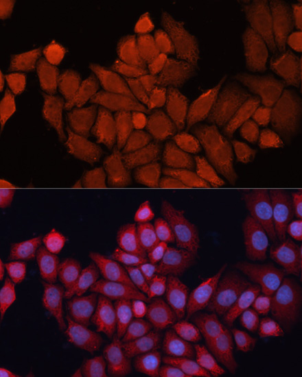 Anti-DNAJB1 Antibody [KO Validated] (CAB5504)