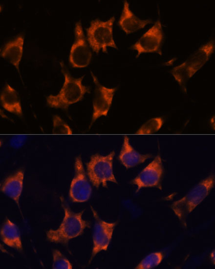 Anti-NDRG4 Antibody (CAB16195)