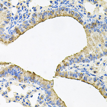 Anti-SKAP2 Antibody (CAB6435)