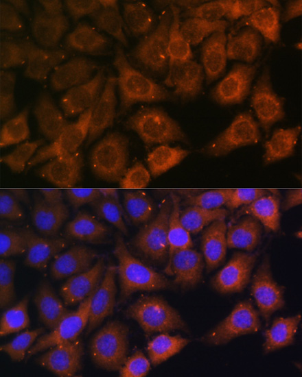 Anti-MYO6 Antibody (CAB13033)