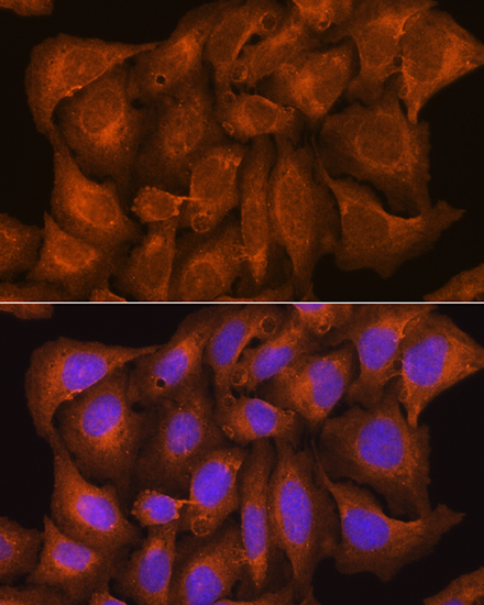 Anti-NCSTN Antibody (CAB14505)