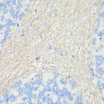 Anti-THY1 Antibody (CAB16986)