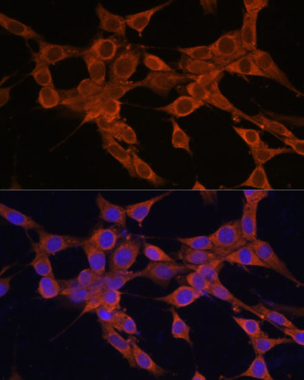 Anti-Bax Antibody [KO Validated] (CAB15633)