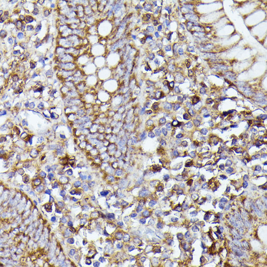 Anti-NLRP3 Antibody (CAB12694)