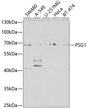 Anti-PSG1 Antibody (CAB13533)