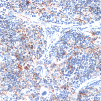 Anti-SLAMF7 Antibody (CAB16565)