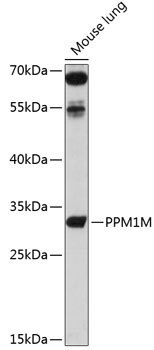 Anti-PPM1M Antibody (CAB14446)