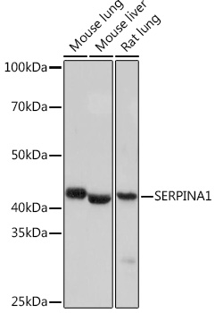 Anti-SERPINA1 Antibody (CAB4966)