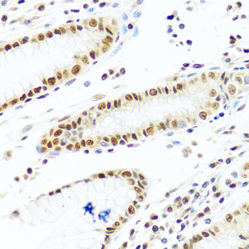 Anti-PRPF19 Antibody (CAB12590)