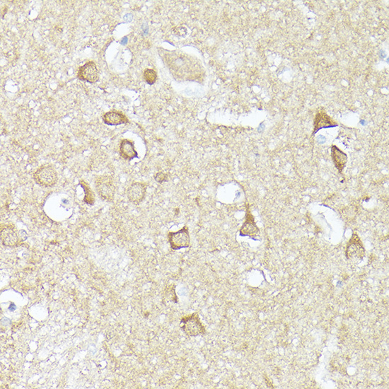 Anti-CX3CL1 Antibody (CAB14198)