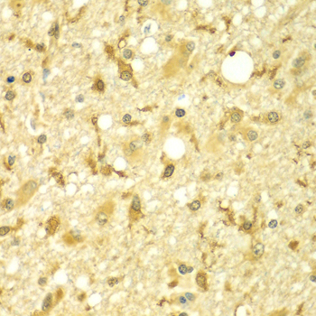 Anti-SPAG16 Antibody (CAB7482)