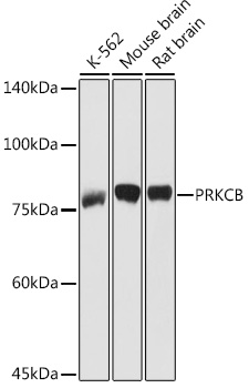 Anti-PRKCB Antibody (CAB13628)