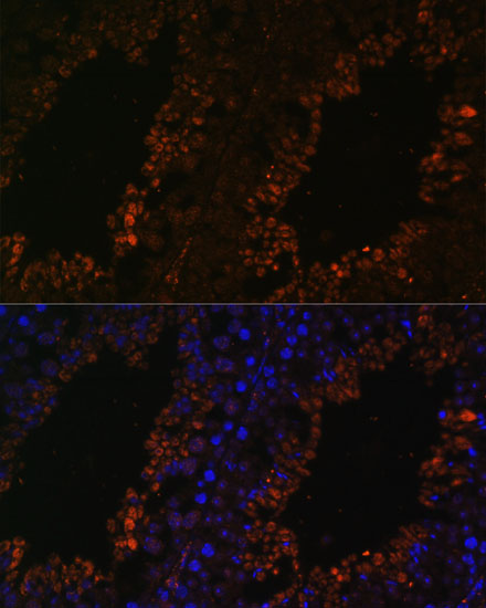 Anti-TPD52L3 Antibody (CAB15544)