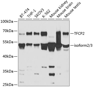 Anti-TFCP2 Antibody (CAB5555)