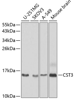 Anti-CST3 Antibody (CAB13291)