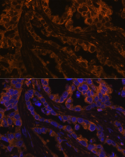 Anti-KRT7 Antibody (CAB2574)