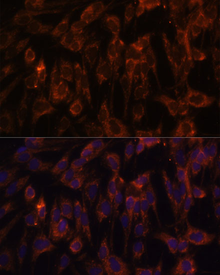 Anti-TLR3 Antibody (CAB11778)