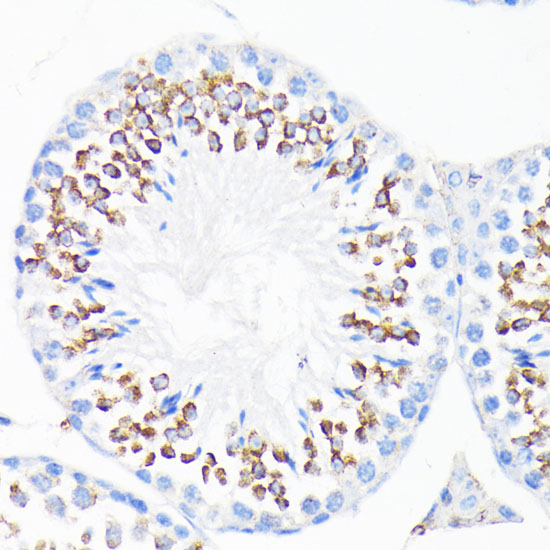 Anti-CAMP Antibody (CAB1640)