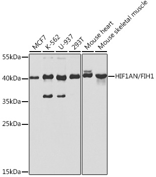 Anti-HIF1AN/FIH1 Antibody [KO Validated] (CAB5466)