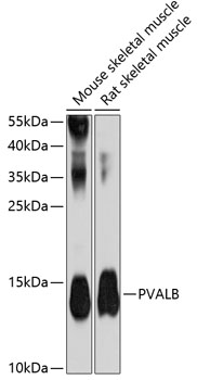 Anti-PVALB Antibody (CAB13538)