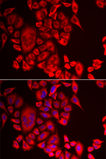 Anti-QPCT Antibody (CAB6711)