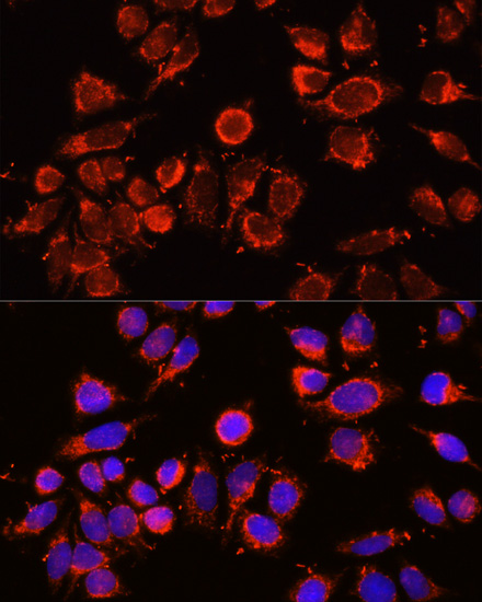 Anti-A2M Antibody (CAB1573)