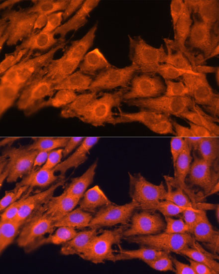 Anti-PRKCB Antibody (CAB5845)