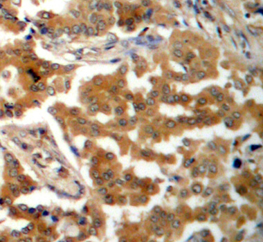 Anti-Phospho-Alpha-adducin-S726 Antibody (CABP0196)