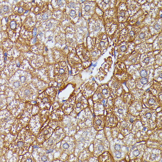 Anti-HDLBP Antibody (CAB6028)