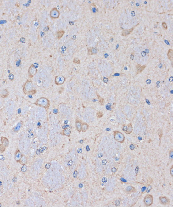 Anti-OR2S2 Antibody (CAB16136)