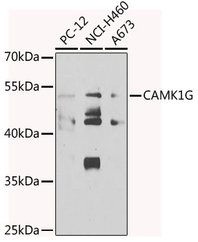 Anti-CAMK1G Antibody (CAB7379)