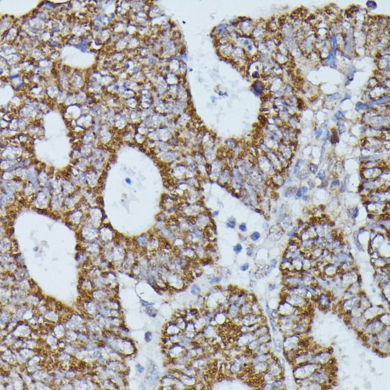 Anti-FLII Antibody (CAB15273)