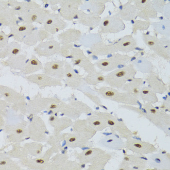 Anti-DDB1 Antibody (CAB2896)