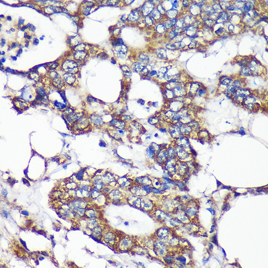 Anti-SLIRP Antibody (CAB15524)