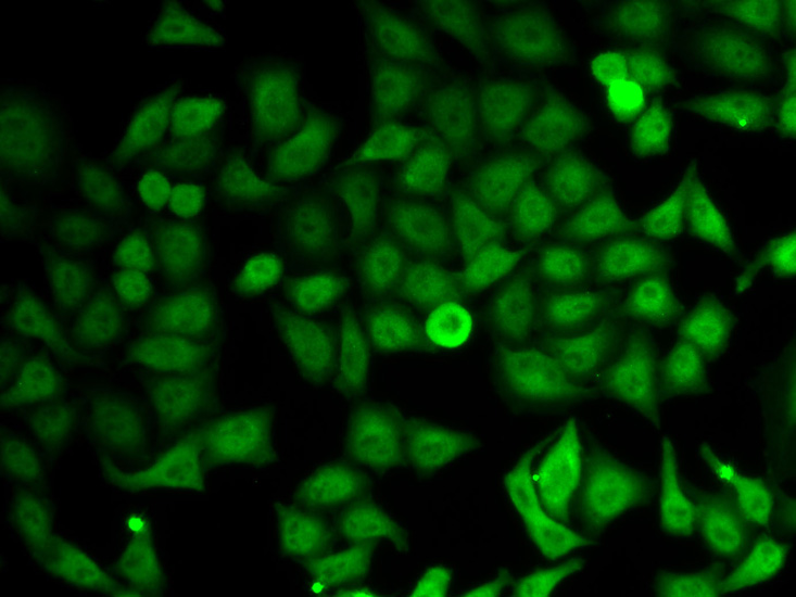 Anti-IMPDH2 Antibody (CAB5350)