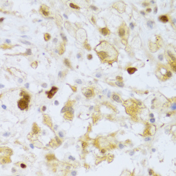 Anti-FCN1 Antibody (CAB6587)