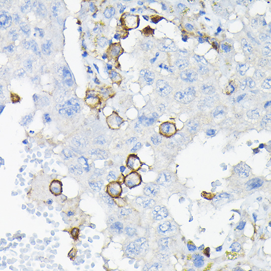 Anti-LILRB4 Antibody (CAB7073)