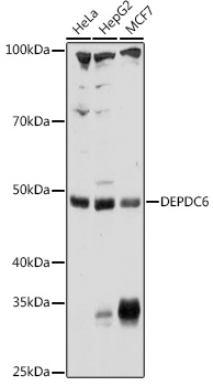 Anti-DEPDC6 Polyclonal Antibody (CAB9447)