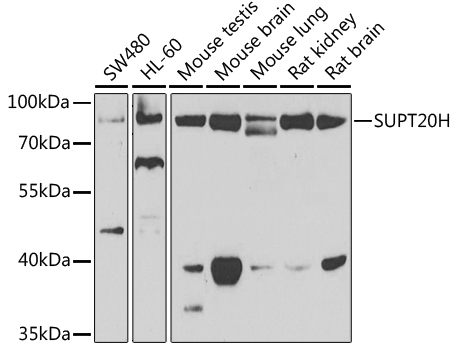 Anti-SUPT20H Antibody (CAB7374)