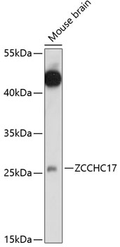 Anti-ZCCHC17 Antibody (CAB14891)