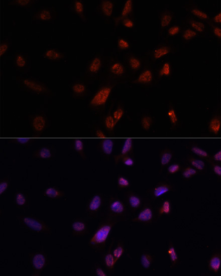 Anti-DMP1 Antibody (CAB16832)