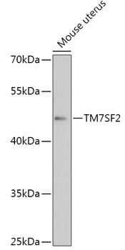 Anti-TM7SF2 Antibody (CAB17541)