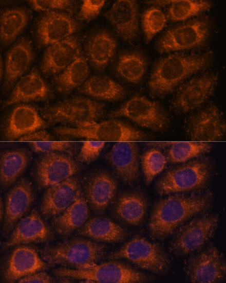 Anti-CCT6B Antibody (CAB14615)