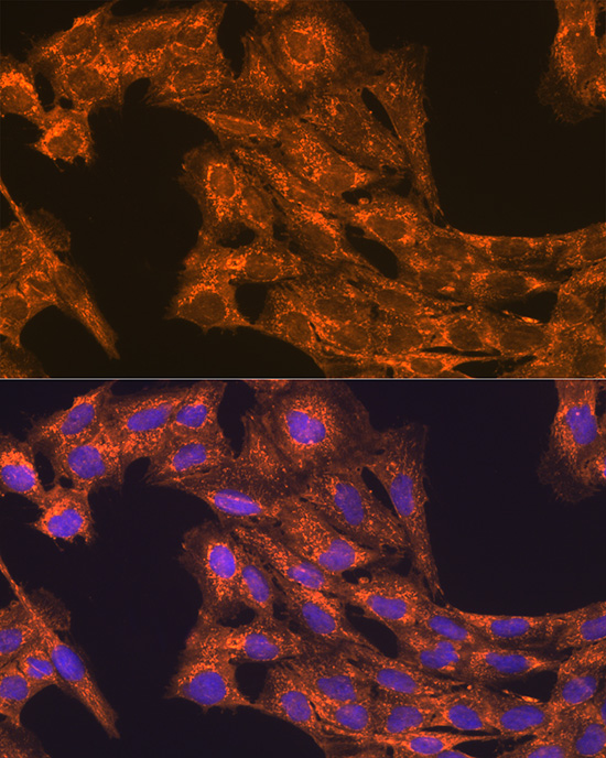 Anti-VEGFB Antibody (CAB2132)