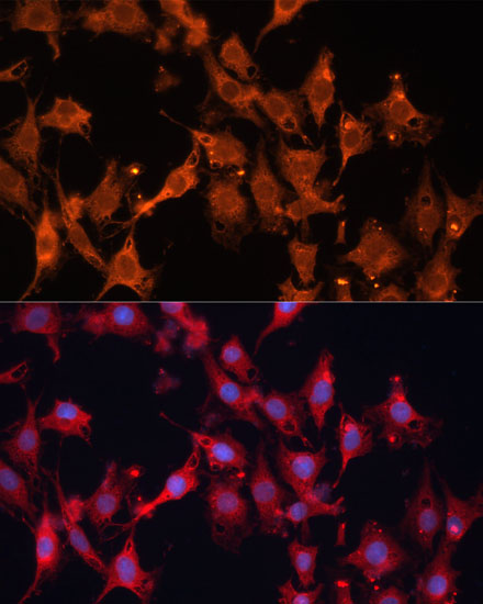 Anti-HSD17B1 Antibody (CAB10839)