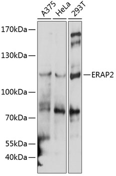 Anti-ERAP2 Polyclonal Antibody (CAB9024)