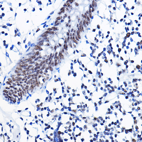 Anti-HDAC1 Antibody [KO Validated] (CAB0238)