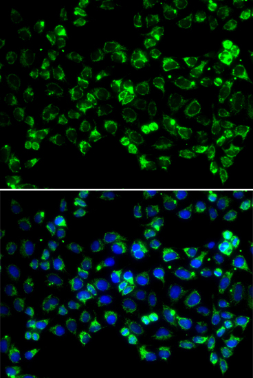 Anti-PINK1 Antibody (CAB11435)