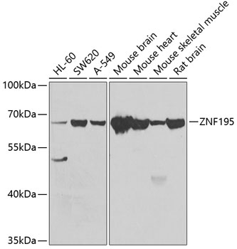 Anti-ZNF195 Antibody (CAB7347)