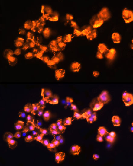 Anti-PRKCB Antibody (CAB5845)